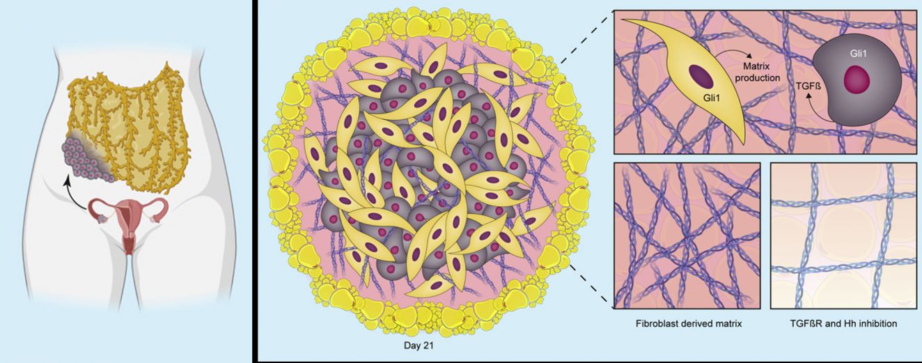 Organoid model of ovarian cancer metastasis published in iScience